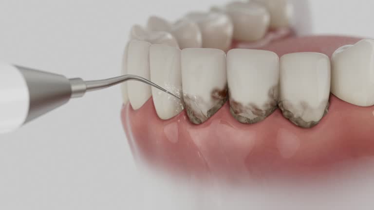 Reliable Root Canal Treatment contractor in Pocahontas County County, WV by Dentist Open Now